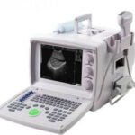 US9618 Portable Ultrasound Scanner with Convex Probe